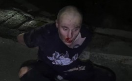 В центральной части Москвы наркоман укусил полицейского, а другому порвал штаны и пнул
